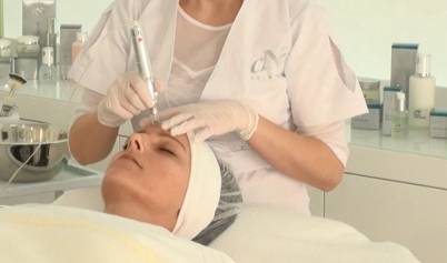 Micro Needling